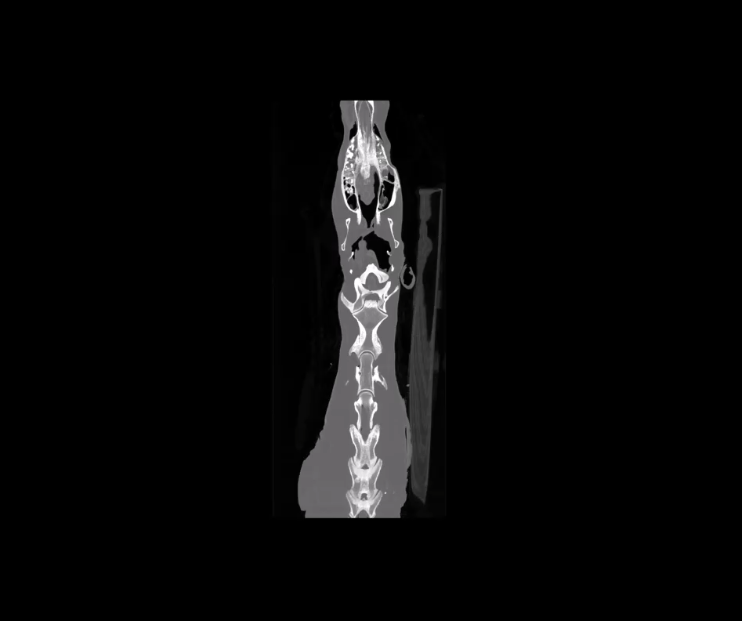 X-ray Image Quality